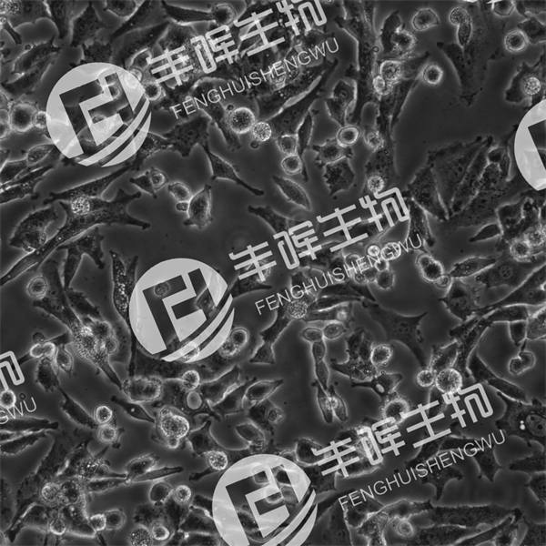 PC12-低分化细胞（大鼠肾上腺髓质嗜铬瘤分化细胞株（低分化））