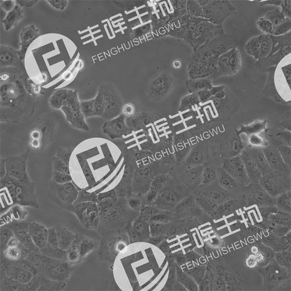 PLC/PRF/5细胞（人肝癌细胞）