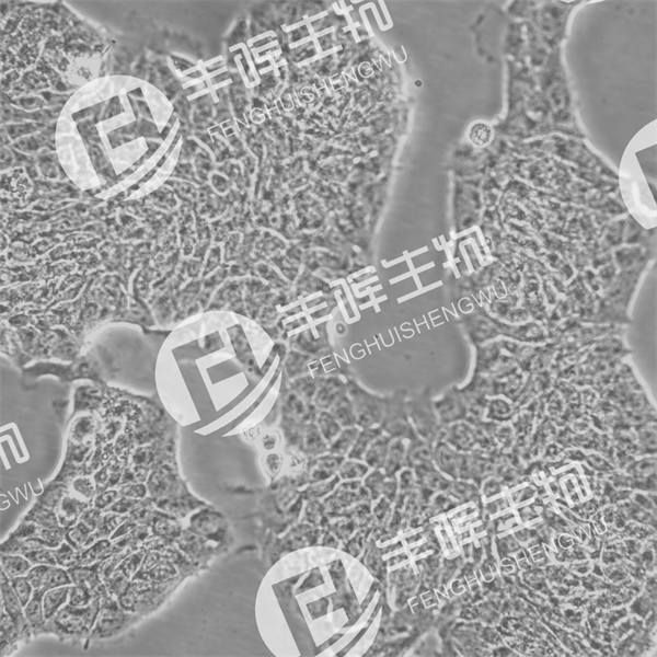 RT4细胞（人膀胱移行细胞乳头瘤细胞）