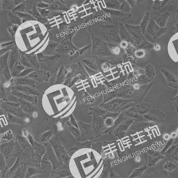 Saos-2细胞（人骨肉瘤细胞）
