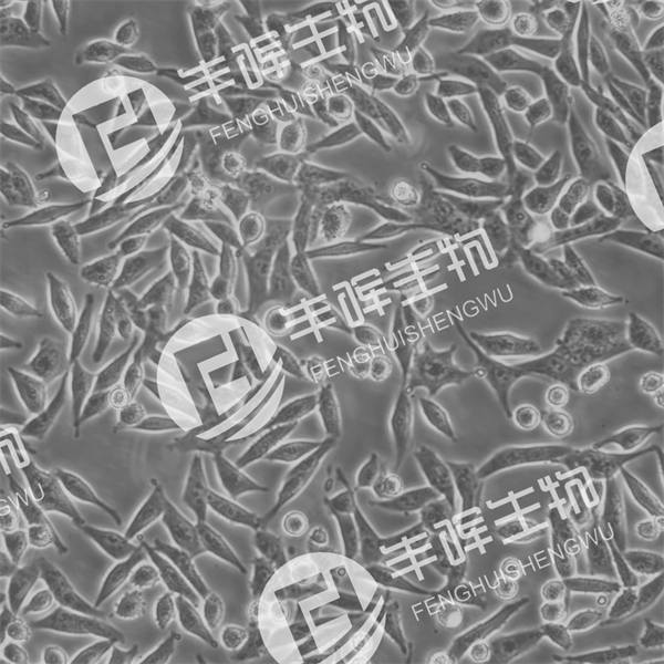 SK-UT-1细胞（人平滑肌肉瘤细胞）