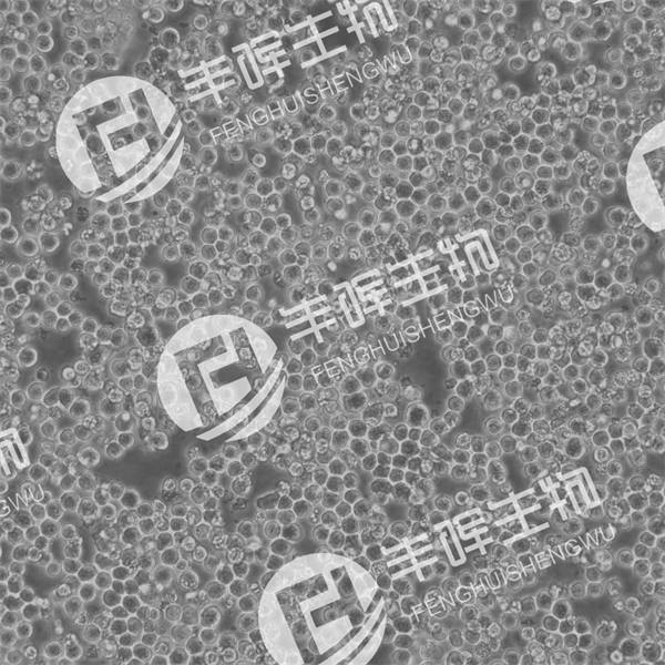 sp2/0细胞（小鼠骨髓瘤细胞）