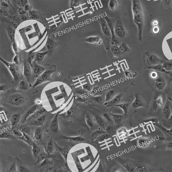 SV-HUC-1细胞（人膀胱上皮永生化细胞）