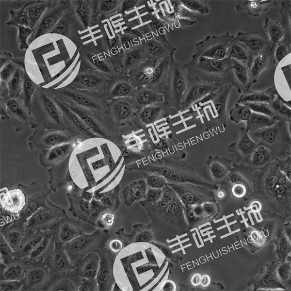 SW1990细胞（人胰腺癌细胞）