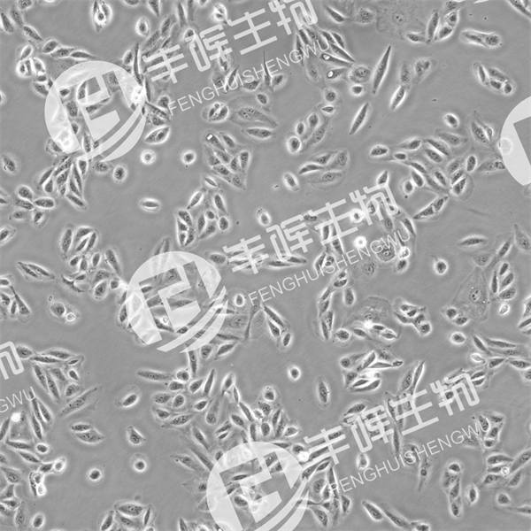 TPC-1细胞（人乳头瘤甲状腺细胞）