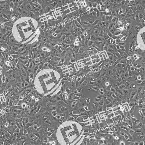 Tu686细胞（人喉癌细胞）