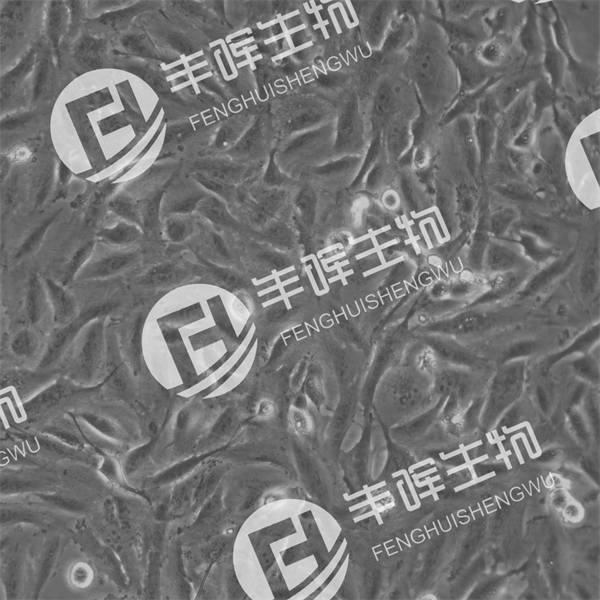 U251细胞（人胶质瘤细胞系）