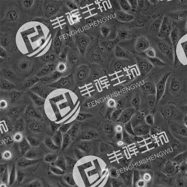 UM-UC-3细胞（人膀胱移行细胞癌）