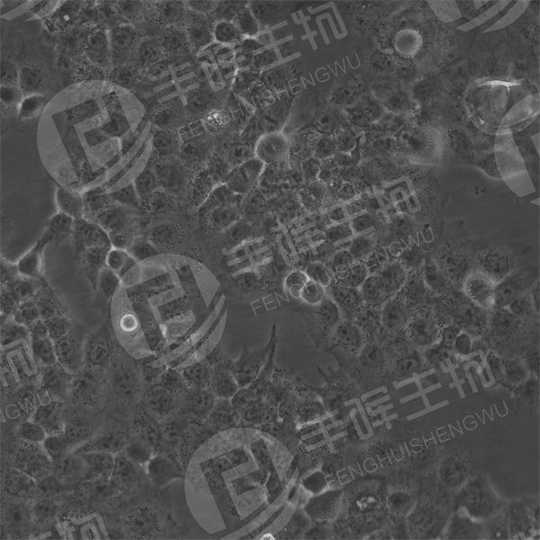 JAR细胞（人胎盘绒膜癌细胞）