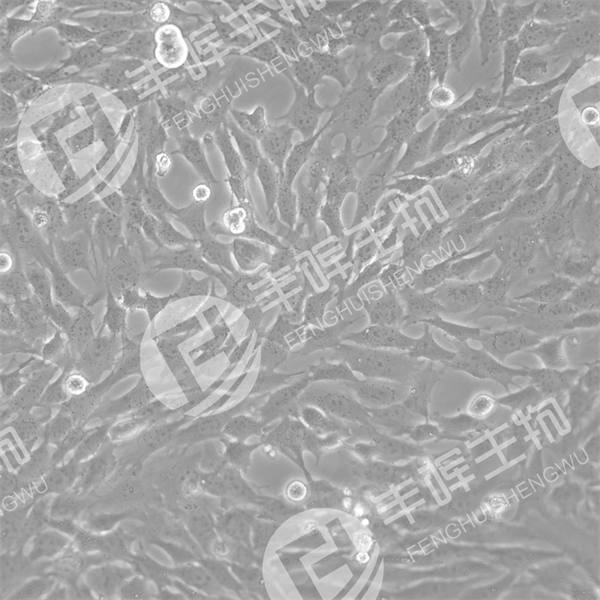 RGC-5细胞（转基因鼠视网膜神经节细胞系）
