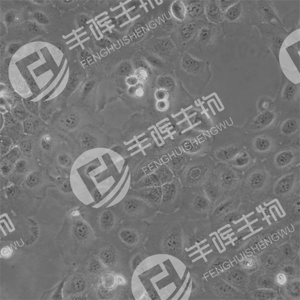 SCC-9细胞（人舌鳞癌细胞）