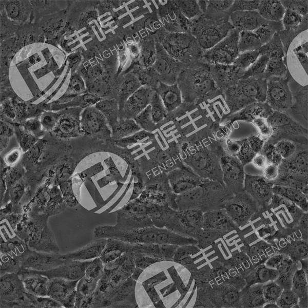 EH-GB1细胞（人胆囊癌细胞系）