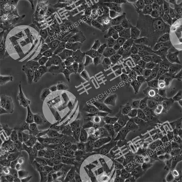 CAES-17细胞（人食管癌细胞）