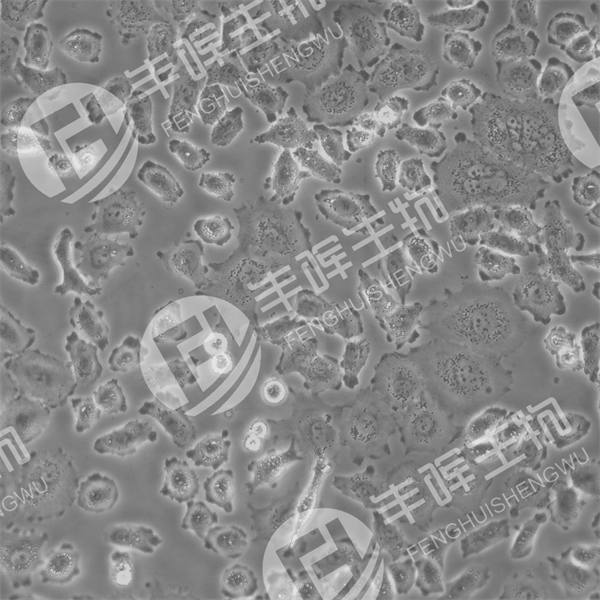 NCI-H838细胞（人非小细胞肺癌细胞）