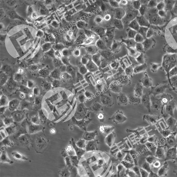 NCI-H1666细胞（人肺癌腺癌细胞）