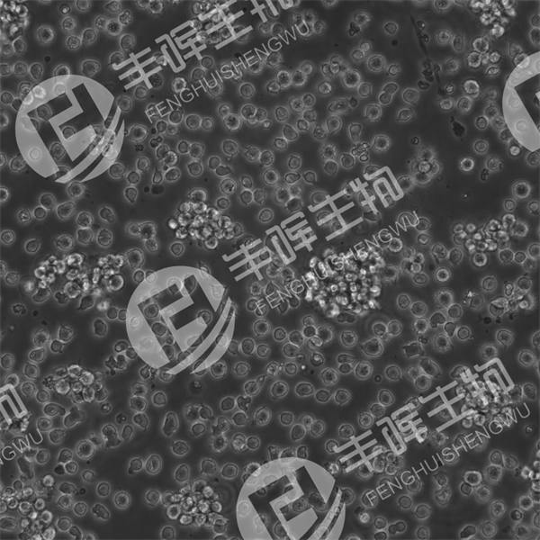 P388细胞（小鼠白血病细胞）