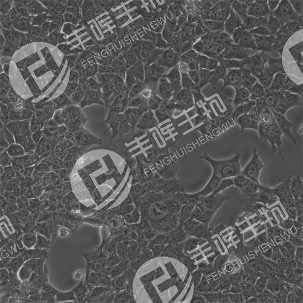 AML12细胞（小鼠正常肝细胞）