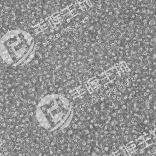 HMy2.CIR细胞（人B淋巴母细胞）