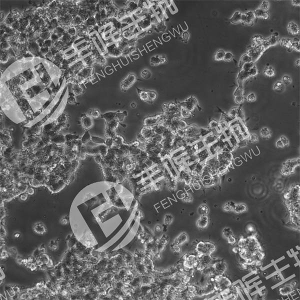 SK-NEP-1细胞（人肾母细胞瘤细胞）