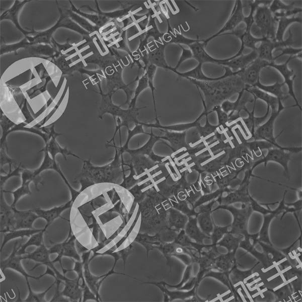 WSS-1细胞(人胚肾细胞)
