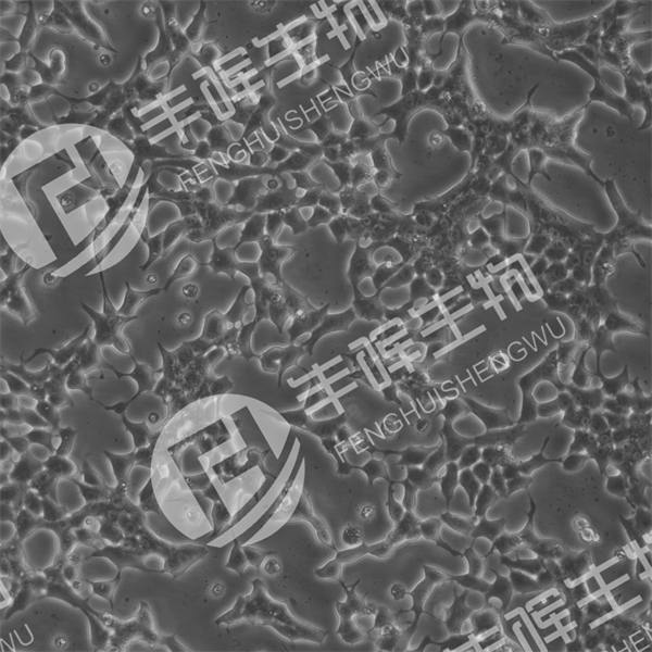INS-1细胞（大鼠胰岛素瘤细胞）