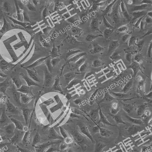 HBVP细胞（人脑血管周细胞）