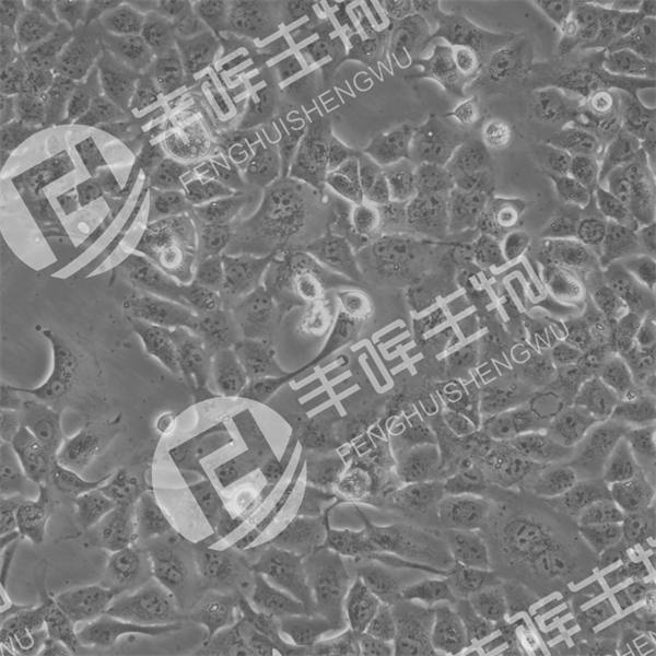 NCI-H441细胞（人肺腺癌细胞）