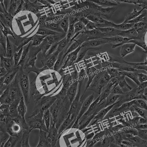 MRC-5细胞（人胚肺成纤维细胞）