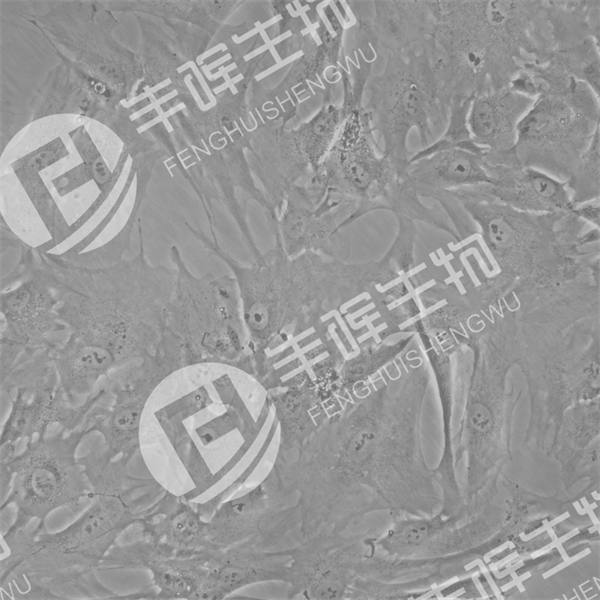 hTERT-HPNE细胞（人胰腺导管细胞）