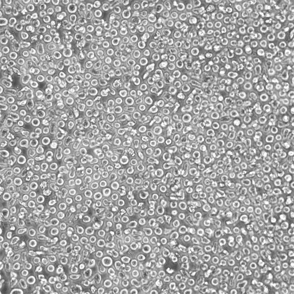 MonoMac6细胞（人急性单核白血病细胞）