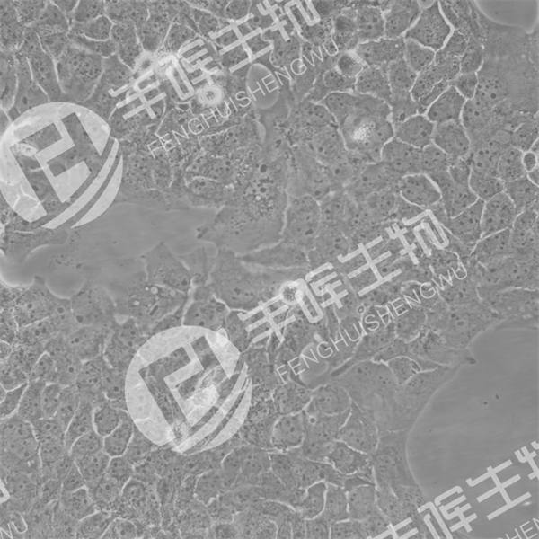 NCI-H2228细胞（人肺癌细胞）