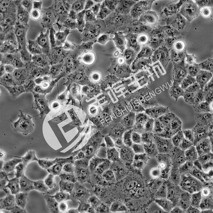 BON-1细胞;人胰腺神经内分泌瘤细胞_