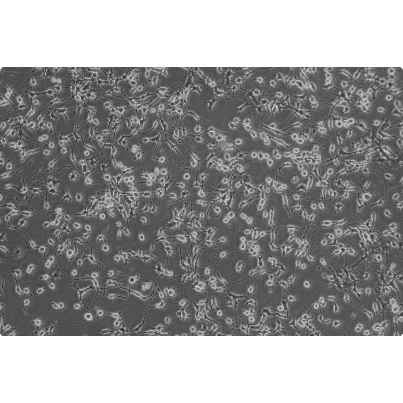 MLO-Y4细胞（小鼠骨样细胞）