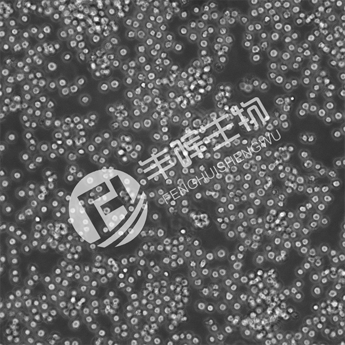B95-8 EBV细胞（EBV 转化的绒猴白细胞）